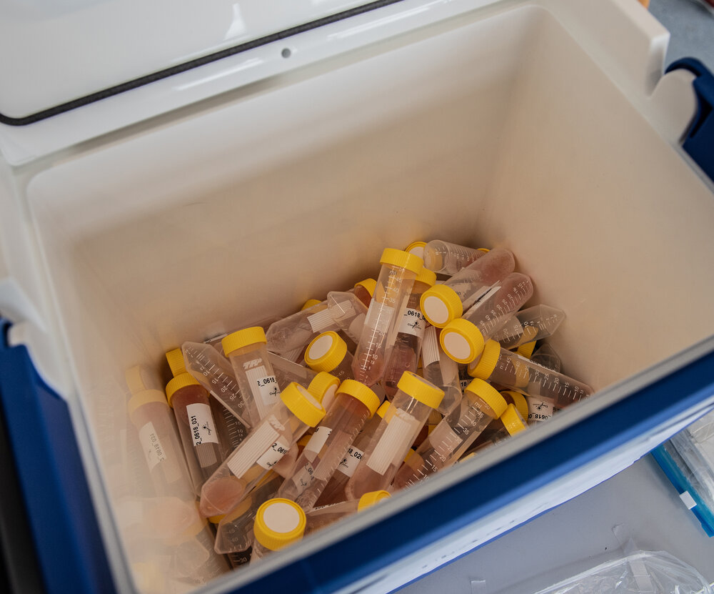 Tubes with saliva samples (sputum)